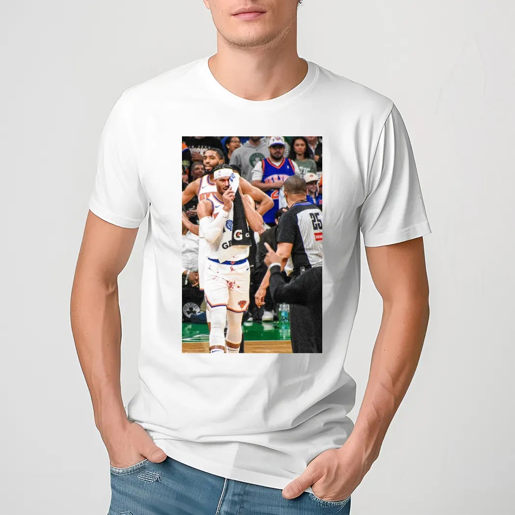 Josh Hart Left Bloodied And Bruised In New York Knicks Vs